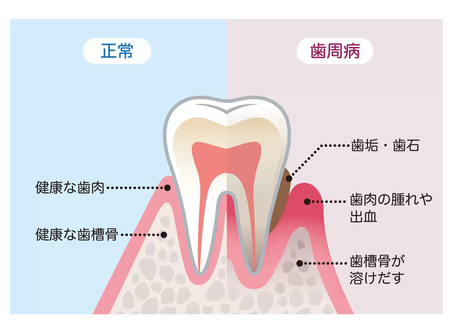 歯周病と全身疾患｜東京・自由が丘の歯医者